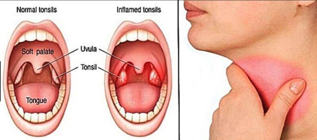 Monroe fingers tongue tonsils free porn image